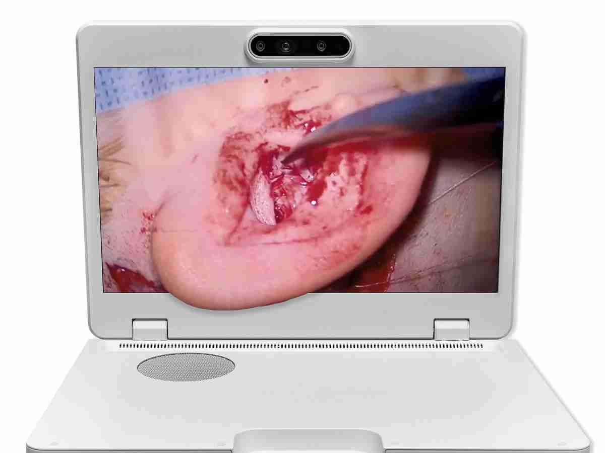 达擎之＂Heads-up 3D显微手术显示系统＂，，，，整合4K裸眼3D显示及眼球追踪系统，，，，具备快速追踪人眼移动位置功能，，，减轻医师长时间维持固定姿势的负担，，让医师能有更宽广清晰的3D立体视野及更舒适的姿势来执行手术。。